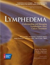 Lymphedema:  Understanding and Managing Lymphedema after Cancer Treatment